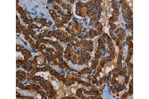 Immunohistochemistry (IHC) image for anti-P53-Induced Death Domain Protein (PIDD) antibody (ABIN2430395) (PIDD 抗体)