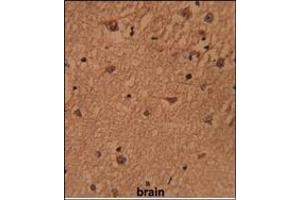 Figure 2. (BRISC and BRCA1 A Complex Member 1 (BABAM1) (Middle Region) 抗体)