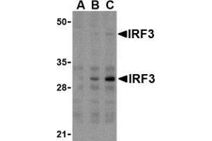 Western blot analysis of IRF3 in U937 whole cell lysate with AP30448PU-N IRF3 antibody at (A) 1, (B) 2, and (C) 4 μg/ml. (IRF3 抗体  (Intermediate Domain))