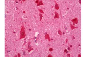 Human Brain, Cortex: Formalin-Fixed, Paraffin-Embedded (FFPE).