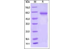 SDS-PAGE (SDS) image for CD274 (PD-L1) (AA 19-238) (Active) protein (Fc Tag,AVI tag,Biotin) (ABIN5674607)