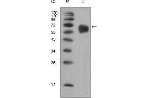 Western blot analysis using FGFR4 mouse mAb against extracellular domain of human FGFR4 (aa22-369).