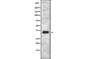 Western blot analysis OR2L2 using HepG2 whole cell lysates (OR2L2 抗体)