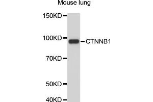 Western blot analysis of extracts of mouse lung, using CTNNB1 antibody (ABIN4903405). (CTNNB1 抗体)