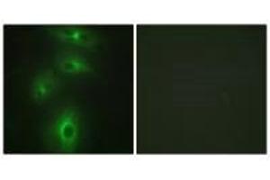 Immunofluorescence analysis of HeLa cells, using TMPRSS3 antibody. (TMPRSS3 抗体  (C-Term))