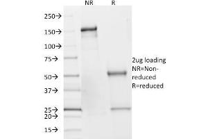 SDS-PAGE Analysis of Purified SDHB Mouse Monoclonal Antibody (SDHB/2382). (SDHB 抗体  (AA 165-273))