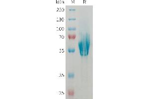 Mucosal Vascular Addressin Cell Adhesion Molecule 1 (MADCAM1) (AA 19-317) protein (His tag)