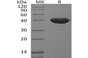 Western Blotting (WB) image for serpin Peptidase Inhibitor, Clade F (Alpha-2 Antiplasmin, Pigment Epithelium Derived Factor), Member 1 (SERPINF1) protein (ABIN7320733) (PEDF 蛋白)