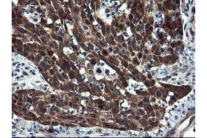Image no. 6 for anti-CCR4-NOT Transcription Complex Subunit 4 (CNOT4) (AA 190-455) antibody (ABIN1491098)