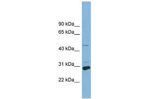 WB Suggested Anti-SLC16A1  Antibody Titration: 0. (SLC16A1 抗体  (Middle Region))