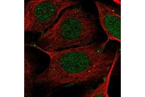 Immunofluorescent staining of U-2 OS with MEF2B polyclonal antibody  (Green) shows positivity in nucleus, cytoplasm and cell junctions. (MEF2B 抗体)