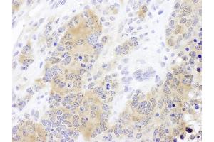Immunohistochemistry (IHC) image for anti-Chaperonin Containing TCP1, Subunit 2 (Beta) (CCT2) (AA 325-375) antibody (ABIN7453613) (CCT2 抗体  (AA 325-375))