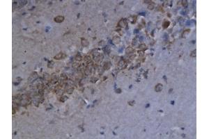 Formalin-fixed and paraffin embedded mouse brain labeled with Anti-CXCL9/MIG Polyclonal Antibody, Unconjugated (ABIN741930) followed by conjugation to the secondary antibody and DAB (CXCL9 抗体  (AA 23-125))