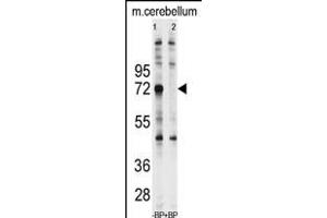 Western blot analysis of anti-Ubiquilin1 Antibody (N-term) (ABIN388965 and ABIN2837880) pre-incubated with and without blocking peptide (BP2176a) in Jurkat cell line lysate. (Ubiquilin 1 抗体  (N-Term))