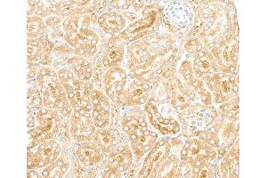 Immunohistochemistry (IHC) image for anti-Ribosomal Protein L7 (RPL7) (C-Term) antibody (ABIN7453643)