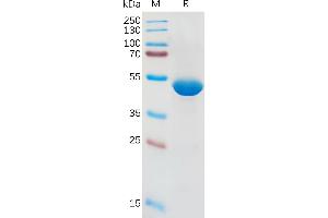 Human IL1B Protein, hFc Tag on SDS-PAGE under reducing condition.