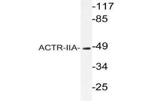 Western blot (WB) analyzes of ACTR-IIA antibody in extracts from rat kidney cells. (ACVR2A 抗体)