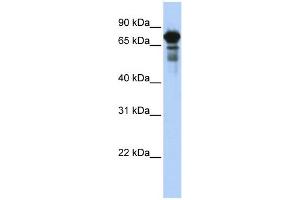 WB Suggested Anti-TRIM29 Antibody Titration:  0. (TRIM29 抗体  (Middle Region))