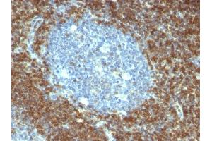 Formalin-fixed, paraffin-embedded human Tonsil stained with Bcl-2 Mouse Monoclonal Antibody (BCL2/796). (Bcl-2 抗体)