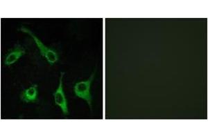 Immunofluorescence analysis of COS7 cells, using EDG1 Antibody. (S1PR1 抗体  (AA 5-54))