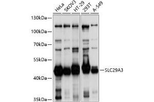 Western blot analysis of extracts of various cell lines, using SLC29 antibody (ABIN6132901, ABIN6147951, ABIN6147952 and ABIN6214611) at 1:1000 dilution. (SLC29A3 抗体  (AA 1-110))