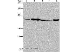 Western blot analysis of Human fetal muscle tissue, Jurkat and 293T cell, Hela cell and mouse liver tissue, using IDH2 Polyclonal Antibody at dilution of 1:600 (IDH2 抗体)