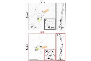 Representative super-resolution Airyscan images taken at a focal plane near the PM of CTL (black) and U18-treated (red) neurons fixed and immunolabeled for KV2.