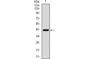 Western blot analysis using COTL1 antibody against HEK293 (1) and COTL1 (AA: 1-142) -hIgGFc transfected HEK293 (2) cell lysate. (COTL1 抗体)