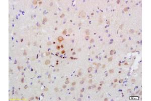 Formalin-fixed and paraffin embedded rat brain labeled with Rabbit Anti PRKAA2/AMPK alpha 2 Polyclonal Antibody, Unconjugated (ABIN680458) at 1:200 followed by conjugation to the secondary antibody and DAB staining (PRKAA2 抗体  (AA 351-450))