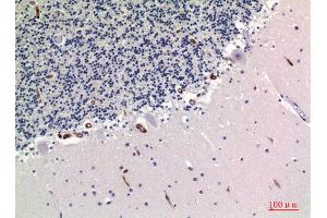 Immunohistochemistry (IHC) analysis of paraffin-embedded Human Brain, antibody was diluted at 1:100. (TRAFs and NIK-Associated Protein (TNAP) (Internal Region) 抗体)