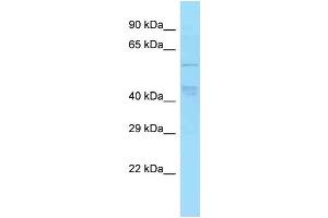 WB Suggested Anti-TBC1D22A Antibody Titration: 1. (TBC1D22A 抗体  (Middle Region))