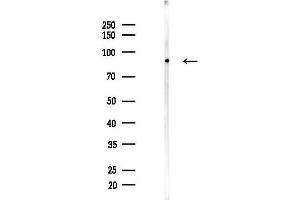 Western blot analysis of lysates from A2780 cells(UV,30 min treatment), using Phospho-CD171/N-CAML1 (Ser1181) Antibody at 1/1000 dilution.