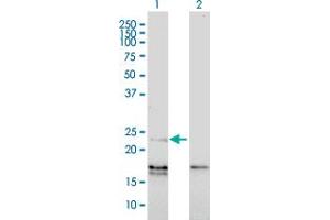 Western Blot analysis of EDN1 expression in transfected 293T cell line by EDN1 monoclonal antibody (M01), clone 3D6. (Endothelin 1 抗体  (AA 113-212))