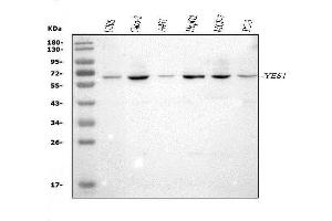 Western blot analysis of YES1 using anti-YES1 antibody (ABIN3042333).