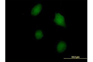 Immunofluorescence of purified MaxPab antibody to LGALS3 on HeLa cell. (Galectin 3 抗体  (AA 1-250))