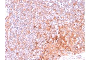 Immunohistochemistry (IHC) image for anti-Tumor Necrosis Factor Receptor Superfamily, Member 4 (TNFRSF4) (AA 59-205) antibody (ABIN6940817)