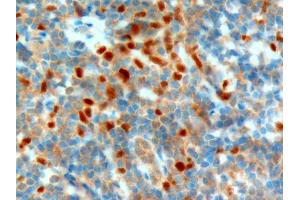 ABIN185112 (1µg/ml) staining of paraffin embedded Human Tonsil. (NET1 抗体  (C-Term))
