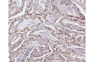 IHC analysis of TOP2A using anti-TOP2A antibody (ABIN7602988). (Topoisomerase II alpha 抗体  (Middle Region))