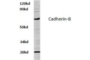 Image no. 1 for anti-Cadherin 8 (CDH8) antibody (ABIN317620) (Cadherin 8 抗体)