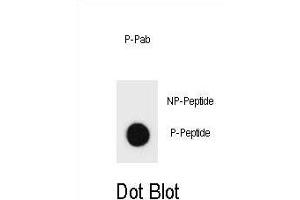Dot blot analysis of TSC1 Antibody (Phospho ) Phospho-specific Pab (ABIN1881930 and ABIN2839980) on nitrocellulose membrane.