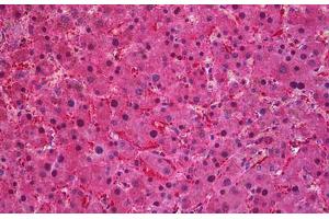 Human Liver: Formalin-Fixed, Paraffin-Embedded (FFPE) (SEC61A1 抗体  (AA 463-476))