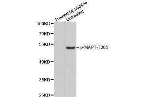 Western blot analysis of extracts from mouse brain tissue, using phospho-MAPT-T205 antibody (ABIN2987497). (MAPT 抗体  (pThr205))
