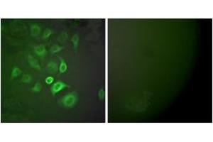 Immunofluorescence analysis of A549 cells, using S100 A1 Antibody. (S100A1 抗体  (AA 10-59))