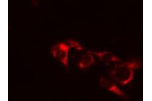 ABIN6274443 staining COLO205 cells by IF/ICC. (EPS8-Like 1 抗体  (Internal Region))
