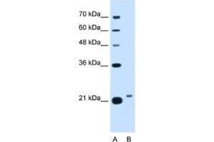 Western Blotting (WB) image for anti-LOC400856 (LOC400856) antibody (ABIN2462913) (LOC400856 抗体)
