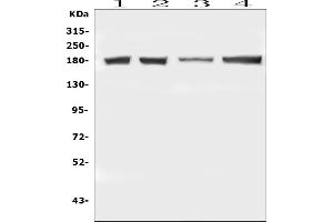 Western blot analysis of DCC using anti-DCC antibody (ABIN7602566).