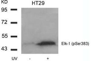 Image no. 1 for anti-ELK1, Member of ETS Oncogene Family (ELK1) (pSer383) antibody (ABIN196614) (ELK1 抗体  (pSer383))