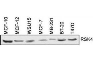 Western Blotting (WB) image for anti-Ribosomal Protein S6 Kinase, 90kDa, Polypeptide 6 (RPS6KA6) antibody (ABIN5023859) (RPS6KA6 抗体)