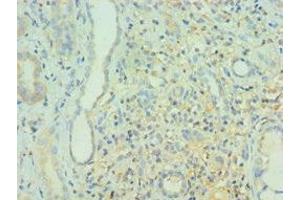 Immunohistochemistry of paraffin-embedded human kidney tissue using ABIN7160382 at dilution of 1:100 (BIN1 抗体  (AA 414-593))