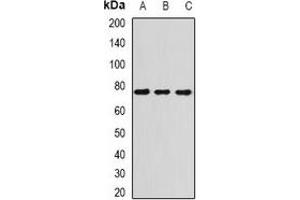 Western blot analysis of ATR expression in H460 (A), Hela (B), mouse spleen (C) whole cell lysates. (ATR 抗体)